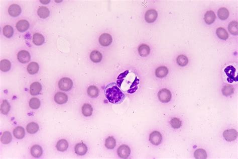 Hepatozoon! Mitä tiesit jo tämän loismatoisella ja piilossa elävästä mikro-pedistä?