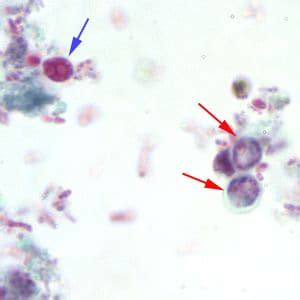  Kryptosporidium! A Tiny Troublemaker Hiding Within